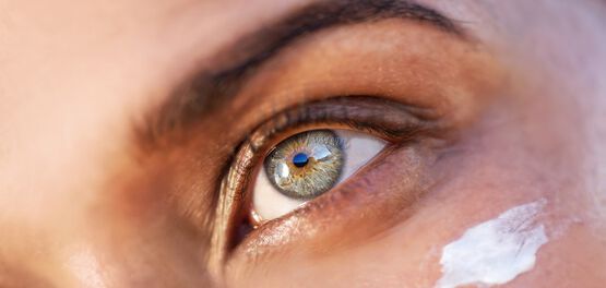 tipos de ojeras